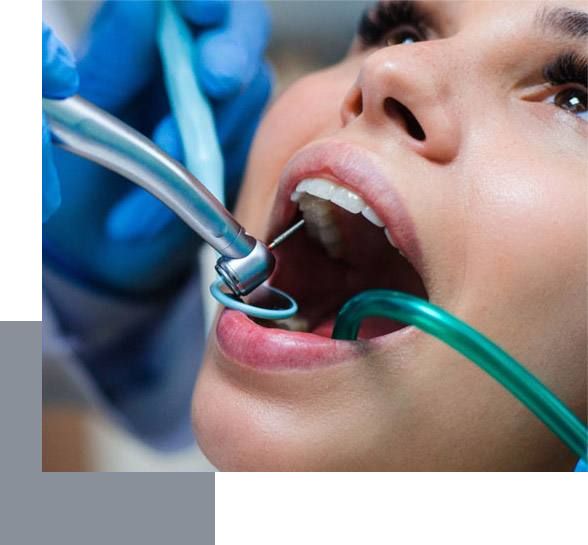 endodoncia